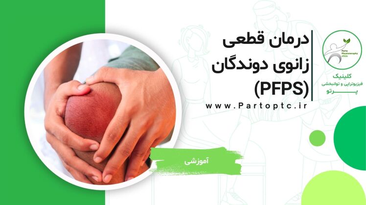 درمان قطعی زانوی دوندگان (PFPS) با فیزیوتراپی | علل و راهکارهای کلینیک فیزیوتراپی پرتو فردیس