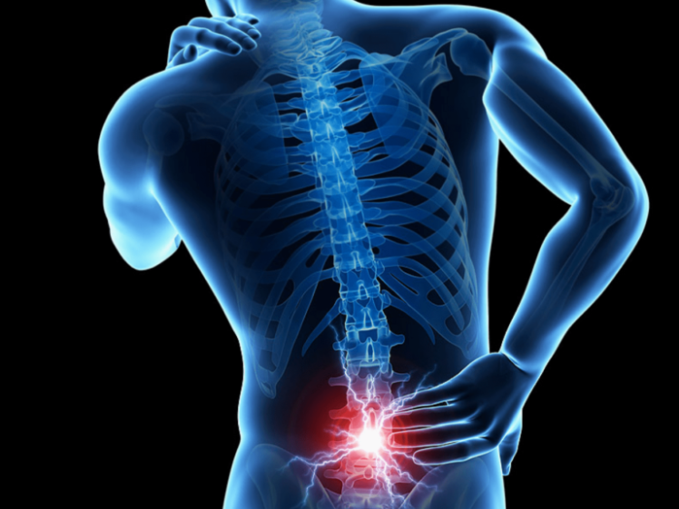 علت درد دنبالچه (Coccydynia) از منظر علمی؛ راهکارهای نوین درمان در مرکز فیزیوتراپی پرتو فردیس